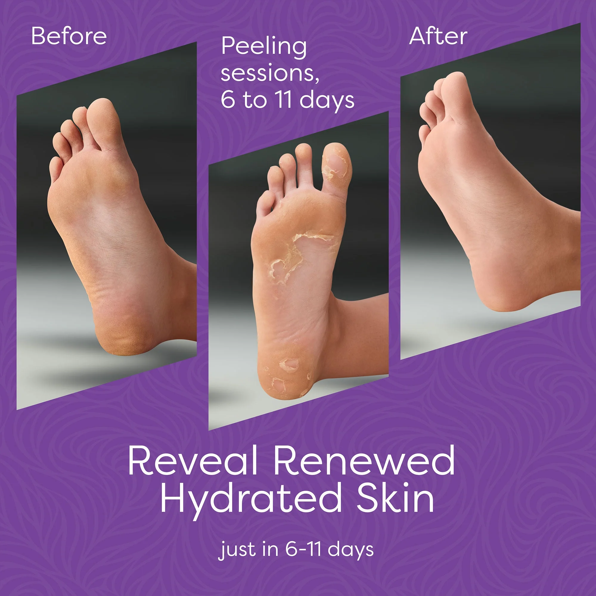 Aesta 3-in-1 Foot Peel Mask, Full-Cycle Foot Care: Revitalizing Mousse + Feet Peeling Mask + Moisturizing Cream | All-Natural Foot Peel Mask for Dry Cracked Feet | Baby Feet Foot Peel Treatment Set - Image 4