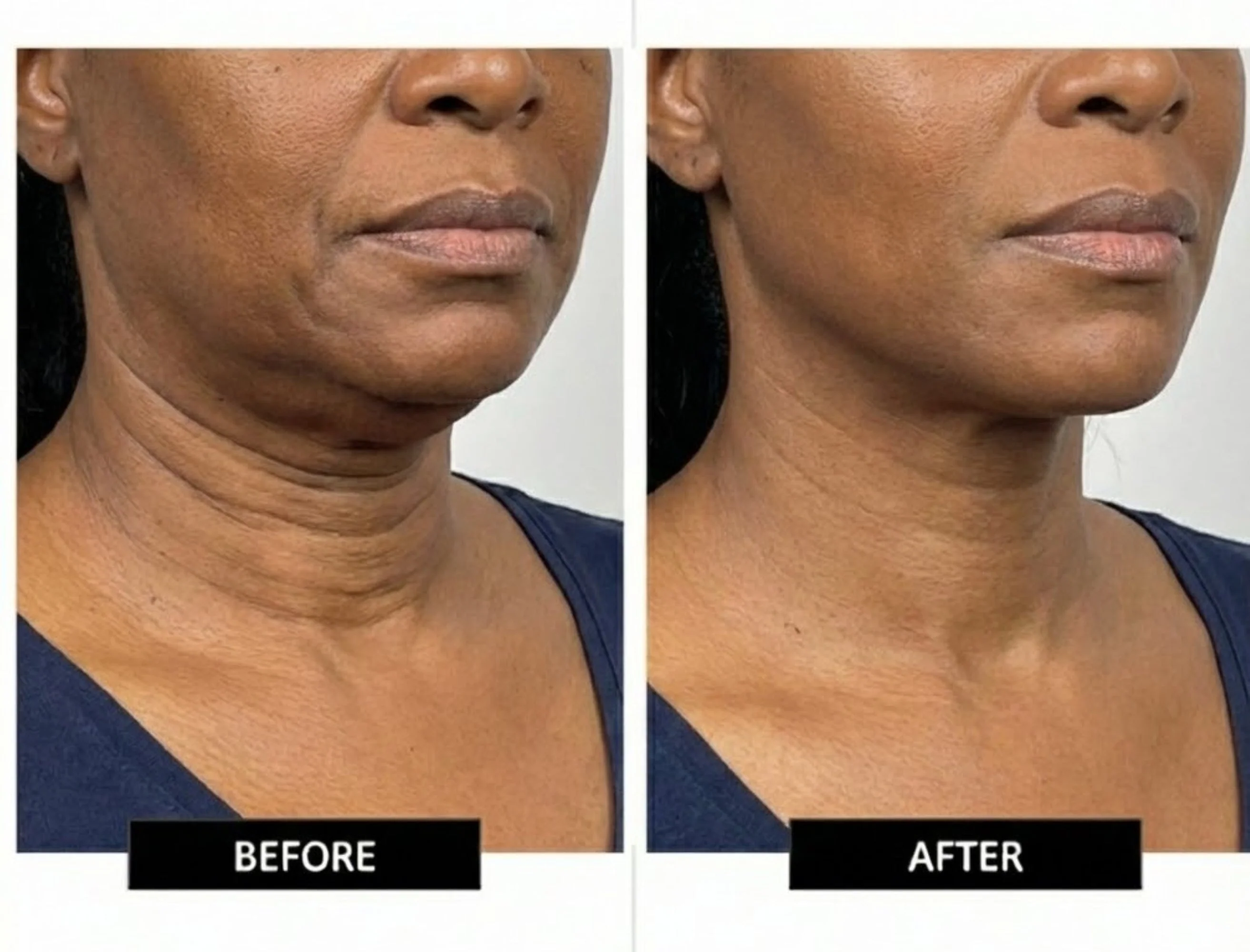 Numiere EMS Neck & Face Lift - Image 16
